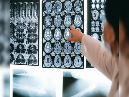 Kerala on alert as 'brain-eating amoeba' kills 19; 5 key facts about the outbreak | केरल में अलर्ट, 'मस्तिष्क भक्षी अमीबा' से 19 लोगों की मौत, जानें प्रकोप से जुड़ी 5 अहम बातें