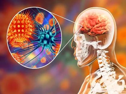Encephalitis signs, symptoms, risk factors, medical treatment, prevention tips | इस खतरनाक दिमाग की बीमारी में मिलती हैं 8 चेतावनी, तुरंत करें ये काम, बच जाएगी मरीज की जान