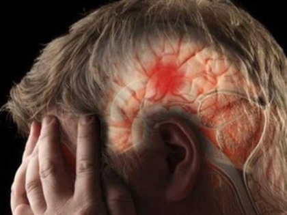 Brain Stroke symptoms in Hindi: Early Signs and Symptoms of Stroke You Must Not Miss | Brain Stroke symptoms: ब्रेन स्ट्रोक के 6 शुरूआती संकेत और लक्षण जो मरीज में साफ नजर आ सकते हैं