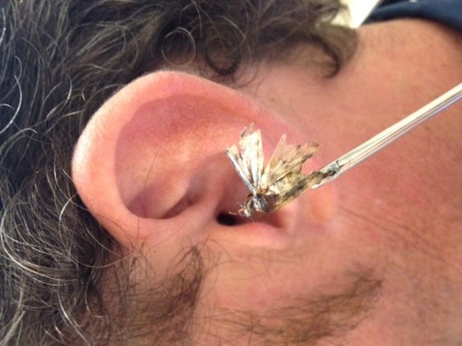 step by step way to remove bug, ear wax from ear, keep these things in mind when something is stuck in your ear | कान में कीड़ा या कोई भी चीज घुसने पर आजमायें ये आसान तरीका, बिना दर्द तुरंत निकल जाएगा बाहर