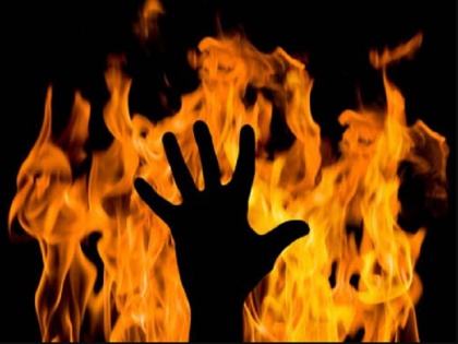 Chhattisgarh: woman molested & burnt by three people when she protested | पति की पहचान वाले तीन लोगों ने महिला के साथ की छेड़छाड़, विरोध किया तो मिट्टी का तेल डालकर आग लगा दी