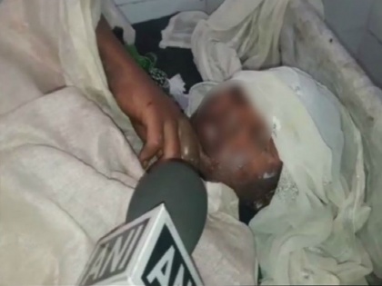 Madhya Pradesh Rajgarh Minor 12 year Dalit girl burnt alive after she protest rape | मध्यप्रदेश: 12 साल की दलित लड़की ने रेप का किया विरोध तो बदमाश ने जिंदा जलाया
