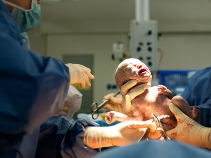 'Preventable' C-section births in pvt hospitals for financial incentives: IIM study reveal | भारत में ऑपरेशन से डिलीवरी का यह है सबसे बड़ा कारण, ऐसे शिशुओं को होता है इन 2 गंभीर रोगों का खतरा