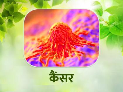 Cancer Prevention Tips in hindi These 6 ways are helpful in cancer | Cancer Prevention Tips: कैंसर में मददगार हैं ये 6 तरीके, जीवनशैली में कर सकते हैं शामिल...