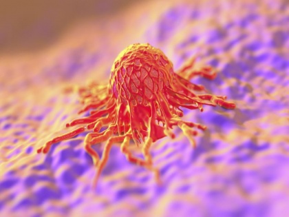 IIT Roorkee breast cancer researchers identify salivary proteins to predict metastatic triple-negative | IIT Roorkee: स्तन कैंसर का पता करना होगा आसान, विकसित की ये तकनीक, आईआईटी रुड़की ने किया कमाल