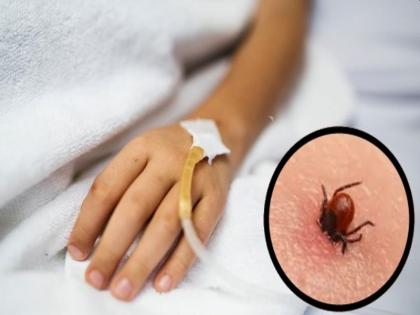 Maharashtra’s Palghar District on High Alert due to Congo Fever, what is Congo Fever, causes, symptoms, risk factors, medical treatment, prevention and precaution tips in Hindi | कोरोना संकट के बीच Congo Fever ने दी दस्तक, अलर्ट जारी, जानिये क्या है कांगो बुखार और बचने के उपाय Maharashtra’s Palghar District on High Alert due to Congo Fever, what is Congo Fever, causes, symptoms, risk factors, medical treatment, prevention and precaution tips in Hindi | कोरोना संकट के बीच Congo Fever ने दी दस्तक, अलर्ट जारी, जानिये क्या है कांगो बुखार और बचने के उपाय