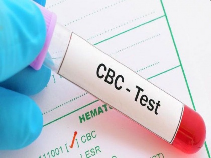 coronavirus treatment: 3 medical test is compulsory for coronavirus patients after 6 days | COVID tretament: निमोनिया, ऑक्सीजन और सांस की कमी से बचने के लिए छठे दिन ये 3 टेस्ट जरूर करा लें कोरोना के मरीज