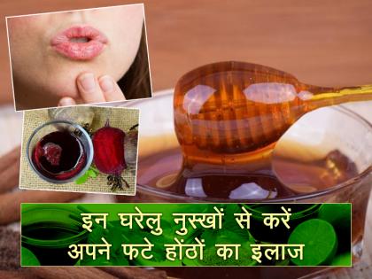 इन घरेलु नुस्खों को आजमायें, फटे होठों से छुटकारा पायें इन घरेलु नुस्खों को आजमायें, फटे होठों से छुटकारा पायें