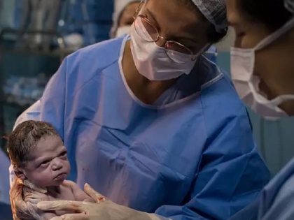 newborn baby shows her frowning at doctor who tries to make her cry | पैदा हुई बच्ची को रुलाने की कोशिश कि तो ऐसे घूरा कि डॉक्टर के छूट गए छक्के