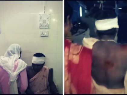 West Bengal: A mentally challenged woman was thrashed by a mob in Jalpaiguri in suspicion of child theft | बंगाल: बच्चा चोर बताकर भीड़ ने कर दी महिला की पिटाई, पुलिस कर रही हैं जाँच