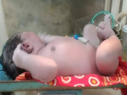 Woman gave birth to a child weighing 5.2 kg in assam | महिला ने 5.2 किलो वजनी बच्चे को दिया जन्म, 20 दिन देरी से शुरू हुई प्रसव पीड़ा, डॉक्टरों का दावा- राज्य का सबसे वजनी नवजात शिशु 