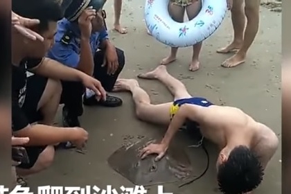 China: Dangerous incident happened with young man swimming, fish caught by private parts | वायरल वीडियो: मछली ने पकड़ लिया समंदर में नहा रहे लड़के का प्राइवेट पार्ट, पूँछ काट कर कराया गया आजाद