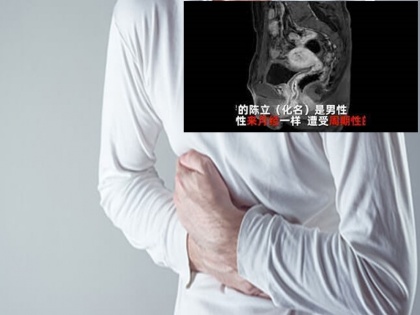 Chinese man suffering from urination problem having ovaries uterus and periods | चीनी शख्स को 20 साल से आ रहे थे पीरियड्स, डॉक्टरों के पास पहुंचा तो अंडाशय और गर्भाशय का भी पता चला