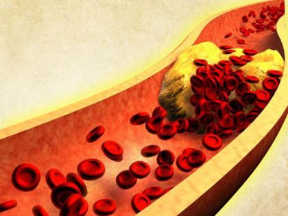 Do's and Don'ts" for cholesterol patients