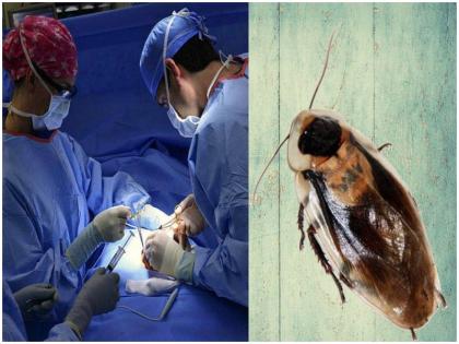 Vet Performed Surgery on Pregnant Cockroach Who Developed Complications While Giving Birth | खतरे में थी प्रेग्नेंट कॉकरोच की जान, ऑपरेशन कर बचाई गई मां-बच्चे की जान, वायरल हुआ वीडियो