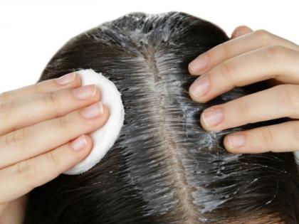 Hair Care: झड़ते बालों से परेशान हैं? बालों में लगाएं ये 5 चीजें, मिलेंगे सुंदर और घने बाल