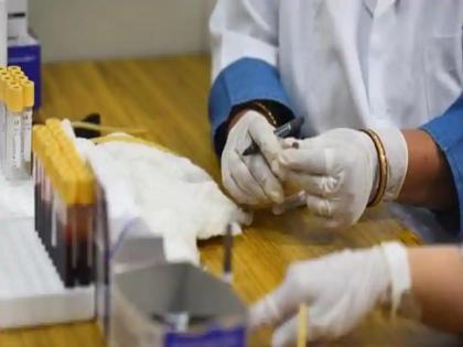 Coronavirus testing in Bihar jamui was among the states that were hard | कोरोना टेस्ट फर्जीवाड़ा मामला: 4 अस्पताल प्रबंधकों को किया गया बर्खास्त, हरकत में आई सरकार