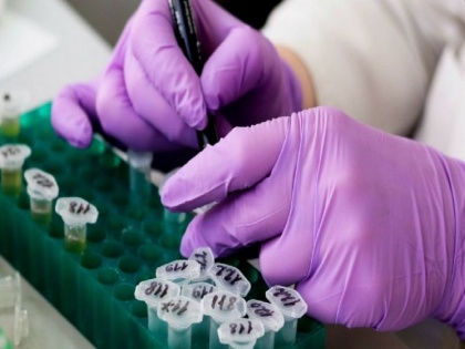 Corona: Order for inquiry to buy rapid antibody test kit from China, ICMR changed rules for purchasing kit | ICMR ने खराब किट खरीदने के लिए नियमों को बदला! चीन से रैपिड एंटीबॉडी टेस्ट किट खरीदने की जांच का आदेश