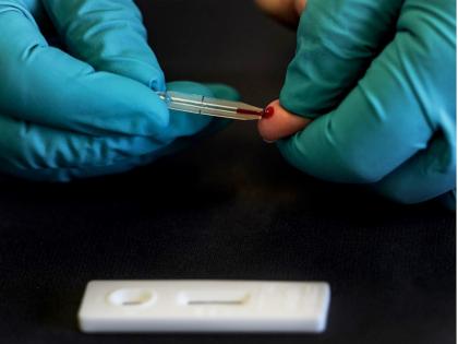 Member of Bihar Legislative Council infected with Coronavirus | बिहार विधान परिषद् के एक और सदस्य कोरोना वायरस से संक्रमित, राज्य में अब तक हो चुके हैं 23 हजार से ज्यादा मरीज Member of Bihar Legislative Council infected with Coronavirus | बिहार विधान परिषद् के एक और सदस्य कोरोना वायरस से संक्रमित, राज्य में अब तक हो चुके हैं 23 हजार से ज्यादा मरीज