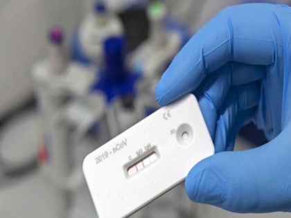 FDA approved first at-home COVID-19 test kit coronavirus testing kit to the doorsteps | Coronavirus Test: इस नई किट से घर पर ही होगा कोरोना वायरस का टेस्ट, जानिये टेस्ट की कीमत