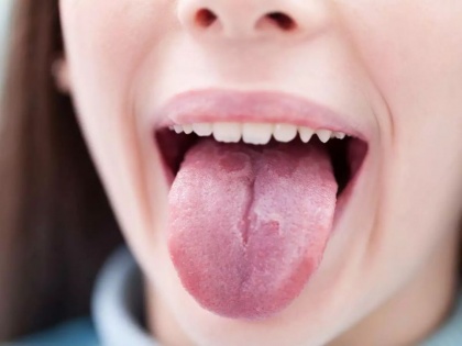 coronavirus symptoms in Hindi: covid-19 severe symptoms you can find on your mouth | Covid 3rd wave: आपके मुंह पर दिख सकते हैं कोरोना के 5 लक्षण, नजरअंदाज न करें
