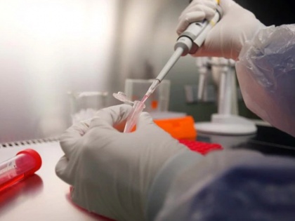 Coronavirus: ICMR ban continue on rapid testing kit, no test even from imported kit from Switzerland | कोरोना संकटः रैपिड टेस्टिंग किट पर ICMR की पाबंदी बनी पहेली, स्विट्जरलैंड से आयातित किट से भी परीक्षण नहीं