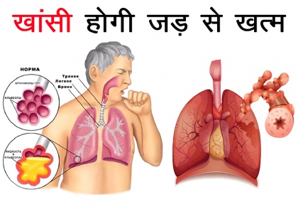 Covid-19 symptoms treatment: coronavirus symptoms fever and cough home remedies in Hindi | Covid-19 symptoms treatment: कोरोना वायरस के दूसरे खतरनाक लक्षण 'खांसी' को जड़ से खत्म करने के 4 घरेलू उपाय
