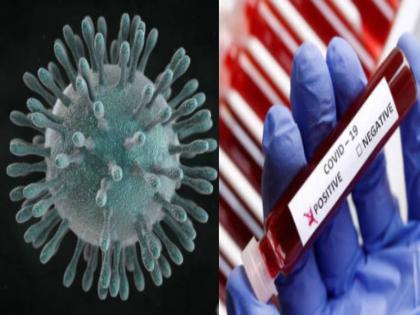 Philippines citizen who was initially tested positive for COVD19 subsequently became negative passed away yesterday | मुंबई में कोरोना वायरस से ठीक हुए फिलीपींस के नागरिक की हुई मौत, ये थी वजह Philippines citizen who was initially tested positive for COVD19 subsequently became negative passed away yesterday | मुंबई में कोरोना वायरस से ठीक हुए फिलीपींस के नागरिक की हुई मौत, ये थी वजह