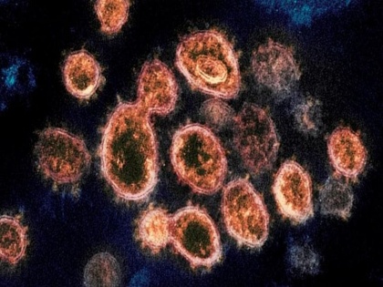 study claim, Covid Alpha variant exhaled 100 times more virus into the air than people infected with the original strains of the virus | COVID-19: अध्ययन में दावा, हवा में 100 गुना अधिक तेजी से फैलता है अल्फा वैरिएंट, बचने के लिए करें दो काम