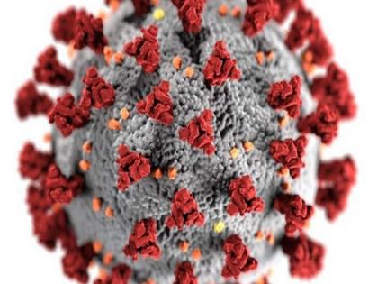 Can covid 19 and black fungus infection occur together? Know what we know till date | कोविड-19 और ब्लैक फंगस संक्रमण क्या एक साथ हो सकते हैं? जानिए इस बारे में अब तक क्या जानकारी आई है सामने Can covid 19 and black fungus infection occur together? Know what we know till date | कोविड-19 और ब्लैक फंगस संक्रमण क्या एक साथ हो सकते हैं? जानिए इस बारे में अब तक क्या जानकारी आई है सामने