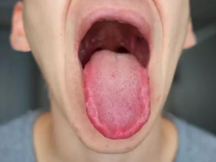 Coronavirus new symptoms, covid-19 all symptoms in Hindi, unusual symptoms of covid, coronavirus new strain symptoms in Hindi | Covid symptoms: हाल ही में मिले हैं कोरोना वायरस के 5 अजीब लक्षण, समझें और जांच कराएं