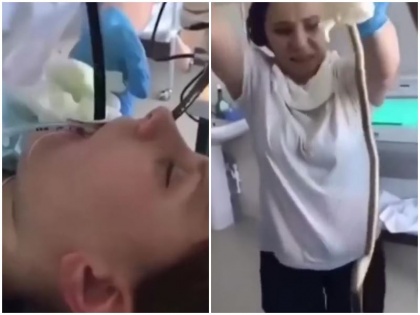 Doctors removed 4 feet long snake from Russian woman mouth Watch video | देखें वीडियो: रूसी महिला के मुंह में घुसा 4 फुट लंबा सांप और फिर....जानें पूरा मामला