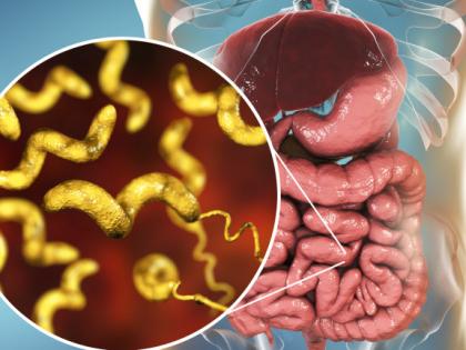 early signs and symptoms of Irritable bowel syndrome IBS, causes, risk factors, treatment, prevention tips, home remedies, diet plan in Hindi | बड़ी आंत को सड़ाने वाली बीमारी IBS होने से पहले शरीर देता है 10 चेतावनी, तुरंत करें ये 4 काम early signs and symptoms of Irritable bowel syndrome IBS, causes, risk factors, treatment, prevention tips, home remedies, diet plan in Hindi | बड़ी आंत को सड़ाने वाली बीमारी IBS होने से पहले शरीर देता है 10 चेतावनी, तुरंत करें ये 4 काम