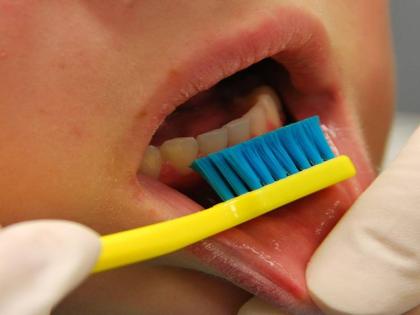 Everyone should adopt 2 into 2 formula to keep teeth healthy know the benefits of this new method | दांतों को हेल्थी रखने के लिए हर किसी को अपनाना चाहिए 2×2 का फार्मूला, जानिए इस नए तरीके के बारे में और इसके फायदे