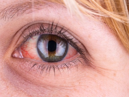 Eyes are forever, how to keep them safe in cold, know health tips | Health Tips: आंखें हैं सदा के लिए, कैसे रखे इन्हें ठंड में महफूज, जानिए यहां