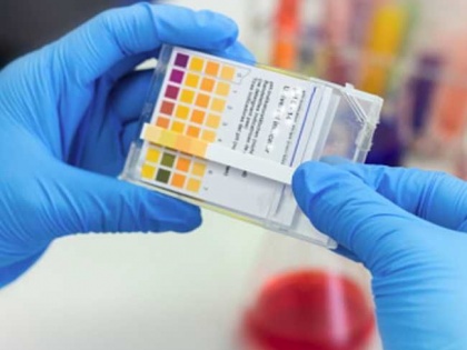 Coronavirus test: ICMR issues advisory, says Govt, private labs can use Feluda paper strip test for RT-PCR based testing | Covid-19: फेलुदा पेपर स्ट्रिप जांच के लिए आईसीएमआर ने जारी किये परामर्श