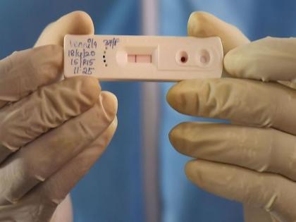 Scientists says, Feluda covid-19 Test Is More Accurate And A Potential Substitute For RT-PCR, know price, availability in Hindi | Feluda Test: वैज्ञानिकों का दावा, एंटीजन टेस्ट है बेहतर है ये टेस्ट, प्रेगनेंसी किट की तरह बदलता है रंग, जानिये कीमत
