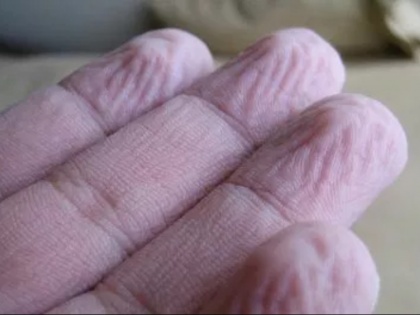 Why fingers skin shrink after keeping in water for a long time | पानी में अधिक देर रखने से क्यों सिकुड़ती है उंगलियों की त्वचा, जानें असली वजह