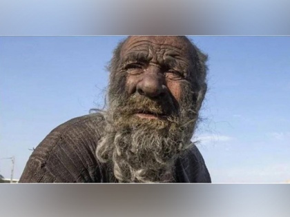 'World's dirtiest man' Amou Haji dies shortly after taking first bath in decades | जिंदगी में पहलीबार नहाने के बाद 94 साल की उम्र में 'दुनिया के सबसे गंदे आदमी' अमो हाजी की मौत
