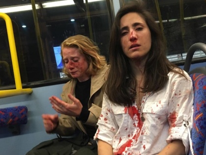 Gay couple beaten for refusing to kiss on bus in London viral facebook | लंदन: समलैंगिक महिलाओं ने बसयात्रियों की माँग पर Kiss करने से किया इनकार तो लोगों ने की पिटाई, वायरल हुई पीड़िता पोस्ट