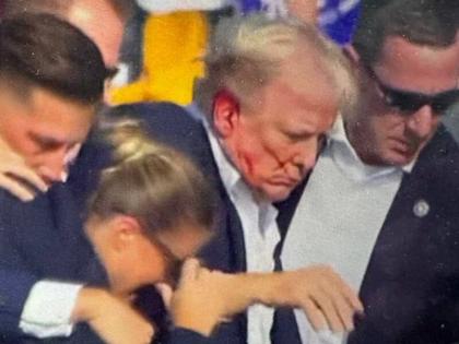 Social media users claim 'The Simpsons' had predicted the attack on Donald Trump, debate continues | सोशल मीडिया यूजर्स का दावा- 'द सिम्पसंस' ने डोनाल्ड ट्रंप पर हमले की भविष्यवाणी की थी, बहस जारी Social media users claim 'The Simpsons' had predicted the attack on Donald Trump, debate continues | सोशल मीडिया यूजर्स का दावा- 'द सिम्पसंस' ने डोनाल्ड ट्रंप पर हमले की भविष्यवाणी की थी, बहस जारी