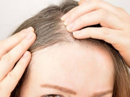If you start white hair before time, then do these home remedies hair fall problem safed bal | hair care: वक्त से पहले सफेद हो रहे बाल तो घरेलू उपायों का करें इस्तेमाल, फिर देखें असर