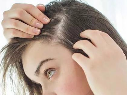 Get rid of hair fall, eat these healthy foods