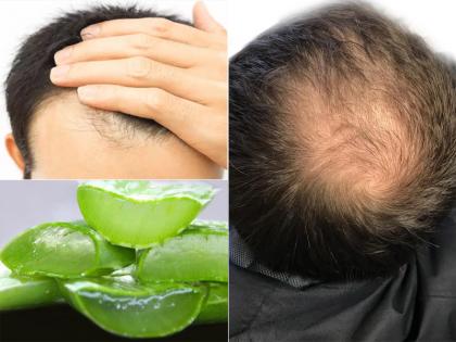 Home Remedies For Hair Fall In Monsoon in Hindi 3 protein rich foods that can repair damage hair | बरसात के मौसम में बालों का टूटना-झड़ना रोकने का घरेलू इलाज, करें इन 3 चीजों का इस्तेमाल