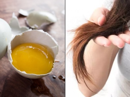 Popular home remedies for hair that are becoming harmful due to lack of correct usage information | बियर, प्याज, अंडा जैसी 5 चीजों के गलत यूज से हेयर डैमेज-गंजेपन का खतरा, सही तरीका दिलाएगा मजबूत-घने बाल
