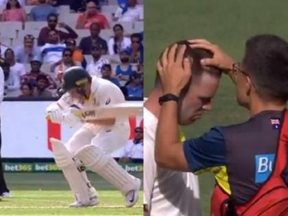 बुमराह की खतरनाक बाउंसर से चटक गया मार्कस हैरिक का हेलमेट