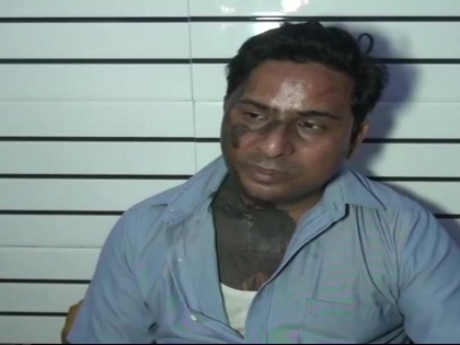 Firozabad: Urdu poet Hashim Firozabadi was attacked with acid & beaten | यूपीः छेड़खानी का विरोध करने गए उर्दू शायर हाशिम फिरोजाबादी पर एसिड से हमला, जल गया शरीर