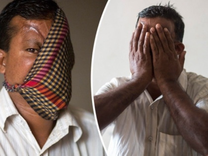 after 20 years this bangladeshi man hashmot ali showed his face | बेटी की मजबूरी ने 20 साल बाद पिता के चेहरे से हटाया पर्दा, चेहरा देख होश खो बैठे लोग!