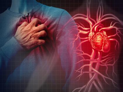 World Heart Day 2023 What is most dangerous among cardiac arrest heart attack and heart failure Know the difference between them | World Heart Day 2023: कार्डियक अरेस्ट, हार्ट अटैक और हार्ट फेलियर में सबसे खतरनाक क्या? जानें इनके बीच का अंतर