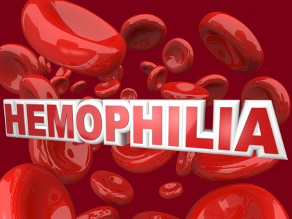 World Hemophilia Day 2020: Blood disorder Hemophilia early signs and symptoms, causes and prevention tips in Hindi | World Hemophilia Day : जानिये इस खून की बीमारी के लक्षण, संकेत और बचाव के तरीके
